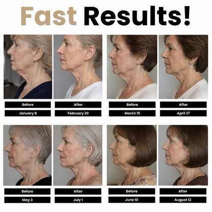 Chinplify™ — Get Rid of Your Double Chin