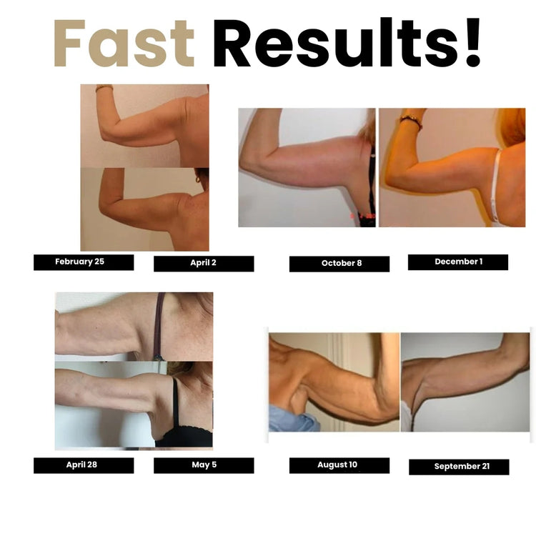 Armivia® DermaTherm Sleeve – Say Goodbye to Bingo Wings